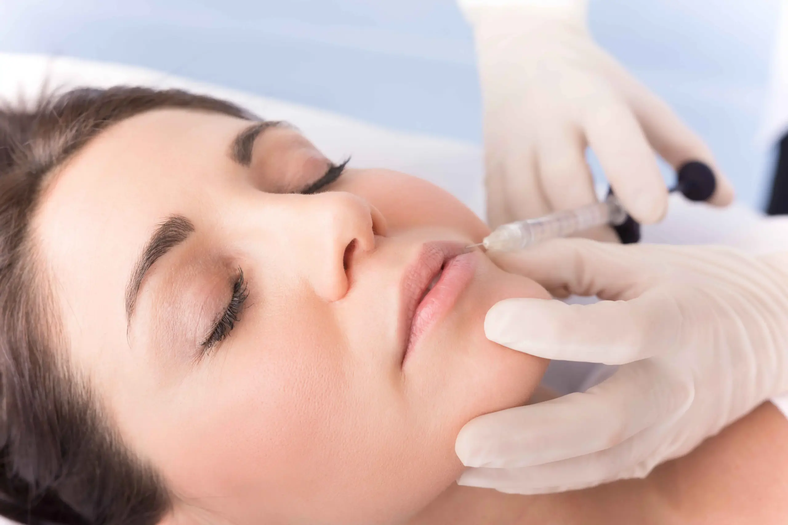 Restylane for Cheeks
